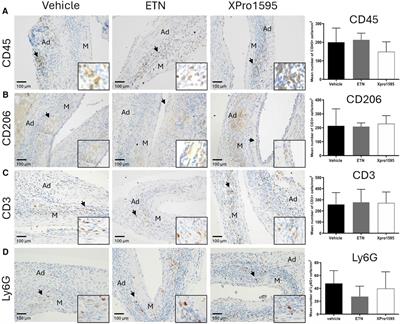 Corrigendum: Selective inhibition of soluble tumor necrosis factor signaling reduces abdominal aortic aneurysm progression